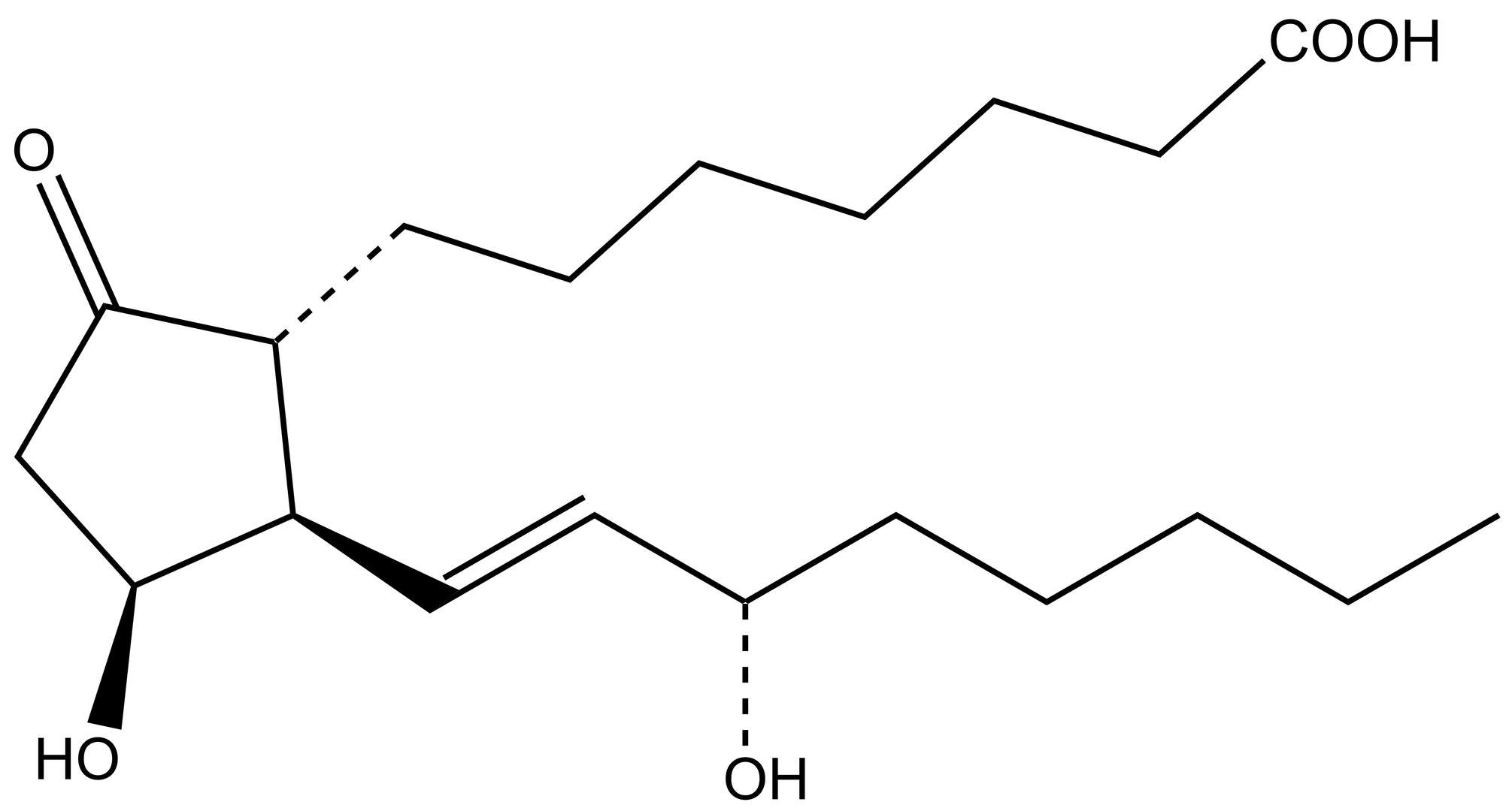 11β-PGE1
