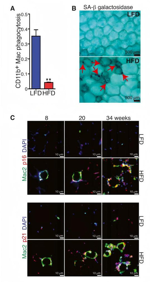 Osteopontin signaling: the link between obese macrophage senescence and fat tissue scarring. (Rabhi, et al., 2022)