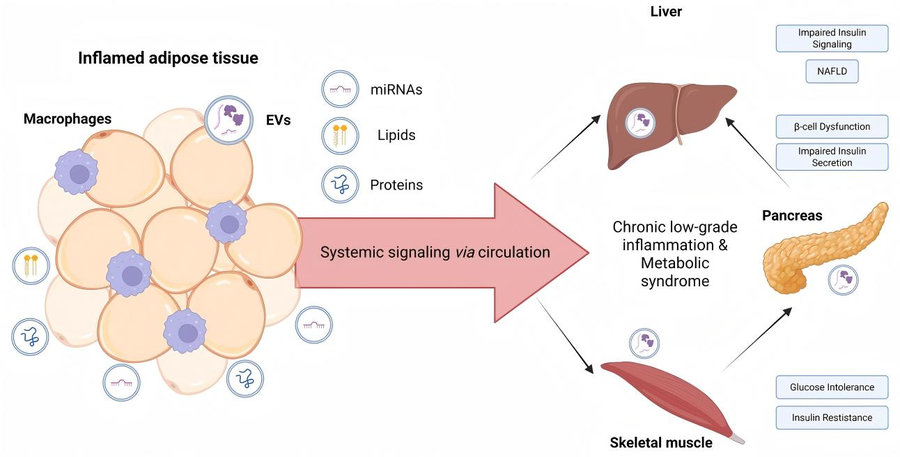 How extracellular vesicles drive obesity complications: liquid biopsy & stem cell EV treatment breakthroughs. (Pavlović, et al., 2026)