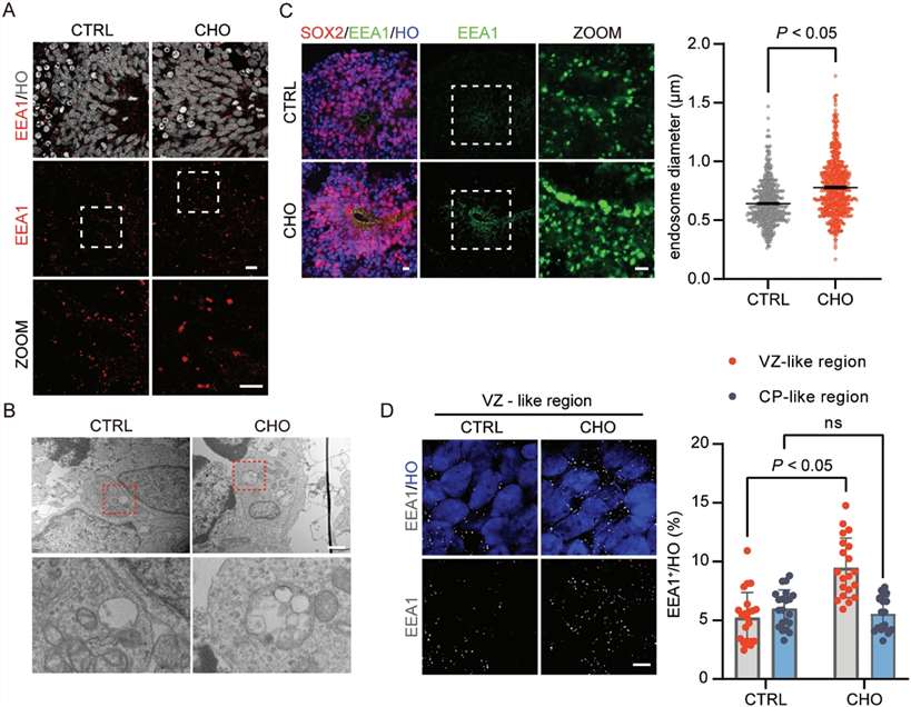 Fig.1 Multi-panel microscopy figure comparing control (CTRL) and cholesterol-treated (CHO) human brain organoids shows enlarged early endosomes. (A) Confocal images stained for the endosome marker EEA1 with nuclear counterstain reveal larger, brighter EEA1-positive puncta in CHO, with zoomed insets. (B) Transmission electron micrographs confirm swollen vesicular/endosomal structures in CHO cells. (C) SOX2/EEA1/Hoechst staining and a scatter plot quantify increased endosome diameter in CHO (P<0.05), most evident in VZ-like regions. (D) Representative VZ-like images and bar graph show a higher EEA1-positive fraction in CHO VZ-like tissue (P<0.05), while CP-like regions show no significant change (ns). (Fan, et al., 2023)