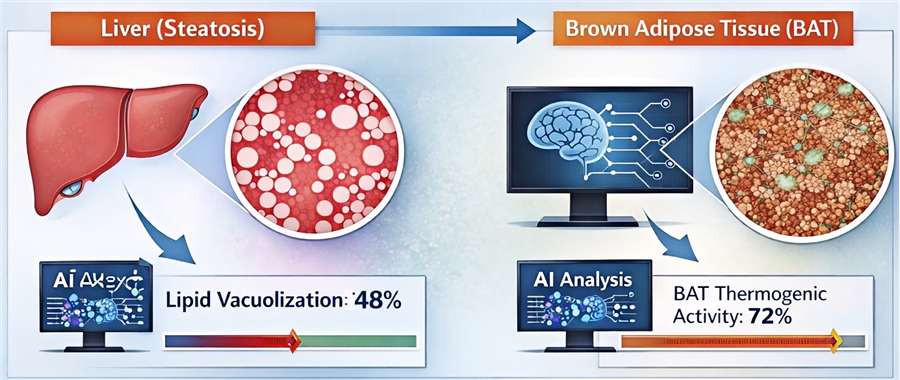 Quantitative Digital Pathology for anti-obesity therapy toxicity testing