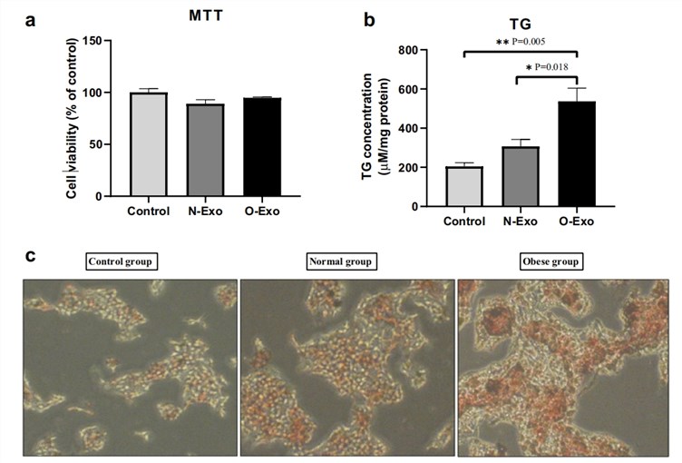 Figure 1 Three-panel image showing the impact of circulating exosomes (from control, normal-weight women [N-Exo], and obese women [O-Exo]) on HepG2 liver cells. Panel (a) (MTT assay): bar graph of cell viability (% of control) – no significant difference between control, N-Exo, and O-Exo groups. Panel (b) (TG concentration): bar graph of intracellular triglyceride (μM/mg protein) – O-Exo group has significantly higher TG vs Control (P=0.005) and N-Exo (P=0.018). Panel (c) (Oil Red O staining): micrographs of HepG2 cells (control, normal, obese groups) – the obese group shows dense orange/brown lipid droplets (marking hepatic steatosis, a hallmark of NAFLD), while control/normal groups have fewer droplets. This figure demonstrates obesity-related exosomes increase hepatic triglyceride accumulation without reducing cell viability. (Afrisham, et al., 2020)