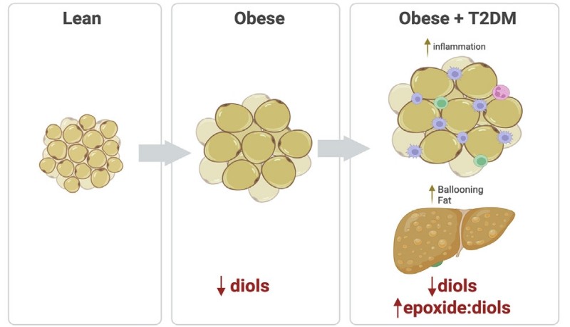 Fig.1Three-panel diagram showing metabolic changes: lean (small, compact adipocytes), obese (enlarged adipocytes, reduced diols), obese + T2DM (inflamed adipocytes, liver ballooning, lower diols + higher epoxide:diol ratios) – key markers of obesity-related metabolic syndrome. (Hateley, et al., 2024)