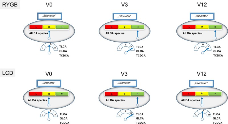 Fig.1 compares BA metabolome dynamics in obese patients across 0 (V0), 3 (V3), and 12 (V12) months for two weight-loss interventions: Roux-en-Y Gastric Bypass (RYGB, top) and Low-Calorie Diet (LCD, bottom). Each section uses a 'Bilometer' (red=low, yellow=baseline, green=high) and a gauge to show BA levels: RYGB shows persistent elevation of total BA species and key BAs (TLCA, GLCA, TCDCA) from V0 to V12; LCD shows transient elevation at V3 that reverts to baseline (V0 levels) by V12. (Schmid, et al., 2024)