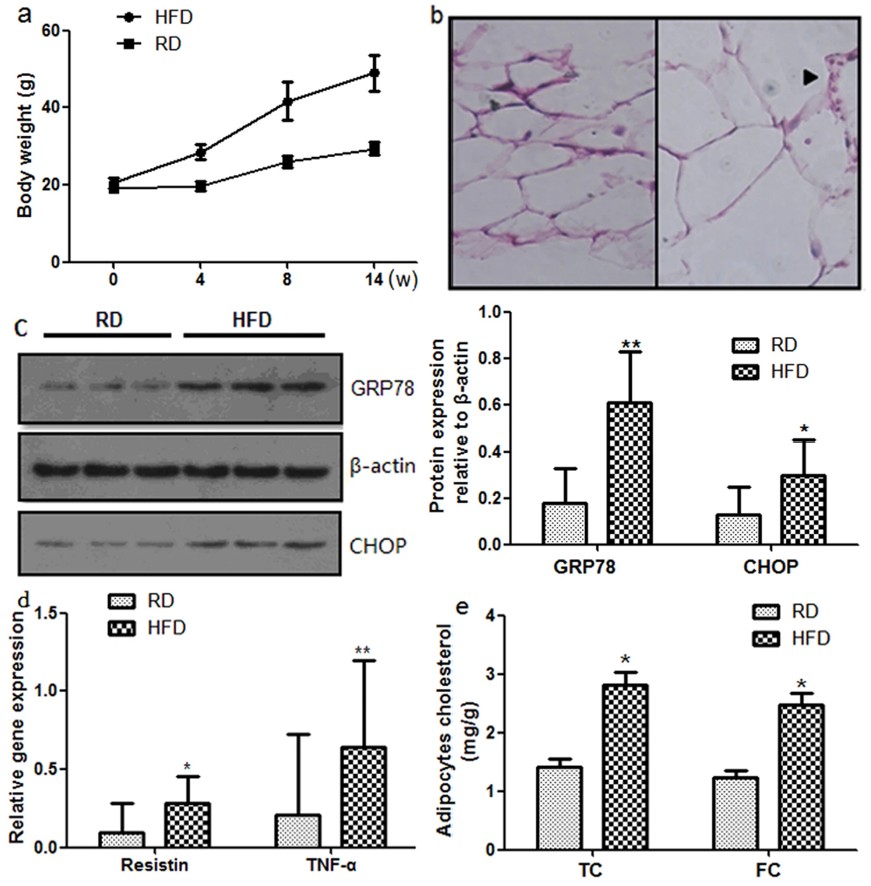 Fig.2 High-fat diet triggers endoplasmic reticulum stress and chronic inflammation. (Chen, et al., 2016)