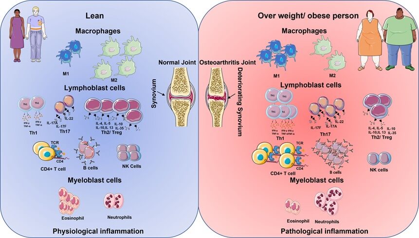 Fig.1 Chematic diagram shows the immune cell being up- and downregulated in lean and overweight/obese individuals.