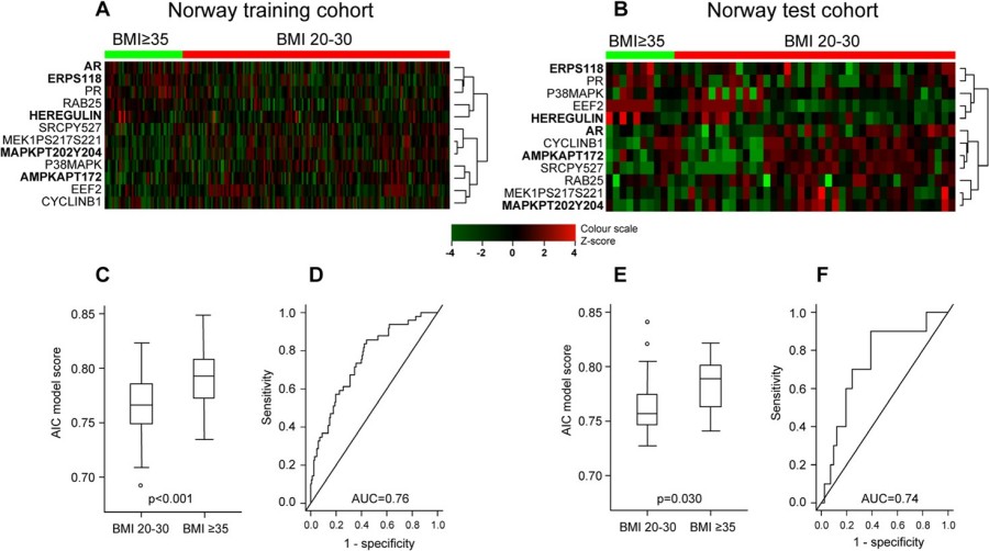 Fig.2 Differential protein expression pattern in endometrioid endometrial cancer patients.