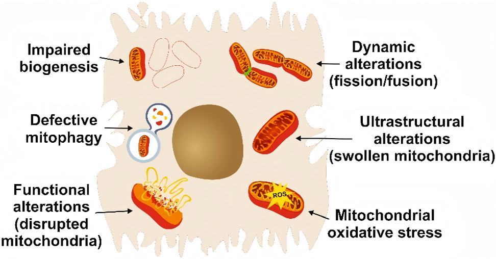 Schematic of hepatocyte mitochondrial damage triggered by obesity & metabolic stress. (Lonardo & Weiskirchen, 2026)