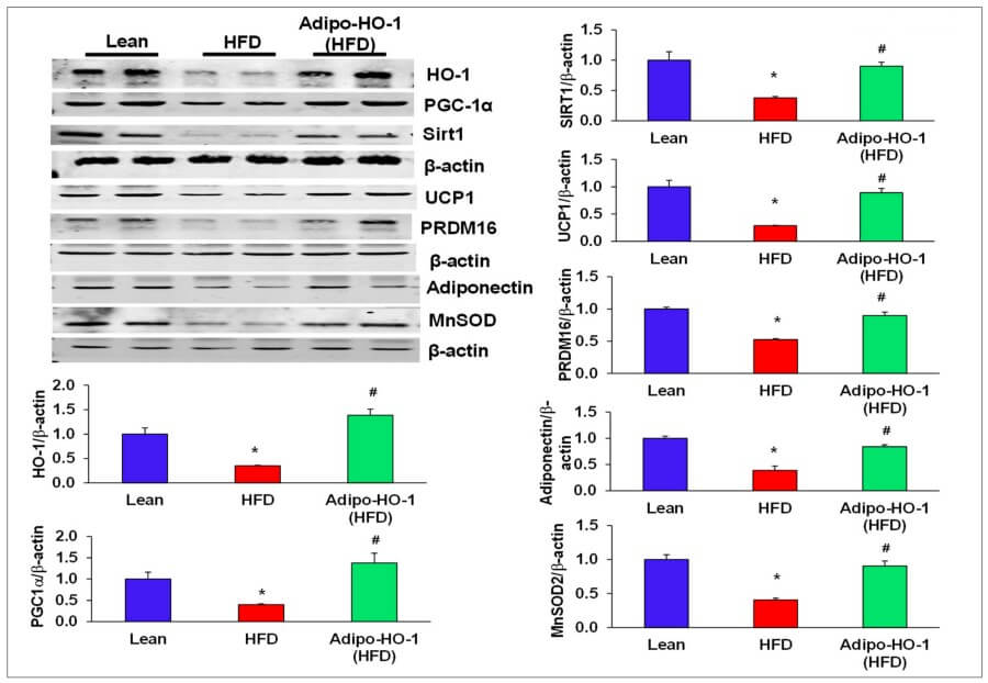 Fig.1 Induction analysis of key proteins in adipocyte metabolism. (Singh, et al., 2020)