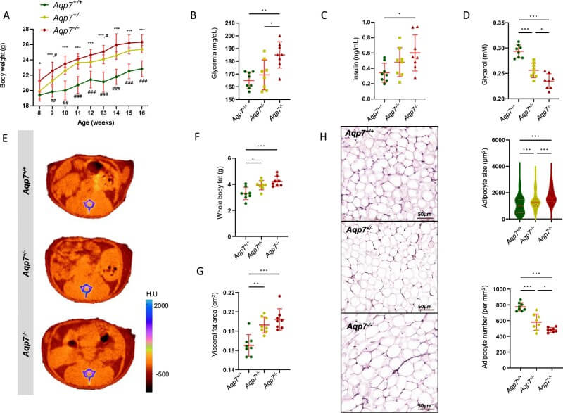 Fig.2 AQP7 deficiency leads to significant increases in body fat in mice, accompanied by abnormalities in glucose and hormone metabolism. (Costa, et al., 2025)