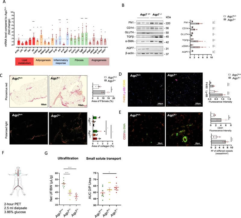 Fig.3 Fat tissue lacking AQP7 exhibits heightened inflammation, fibrosis, abnormal vascular structure, and impaired function. (Costa, et al., 2025)
