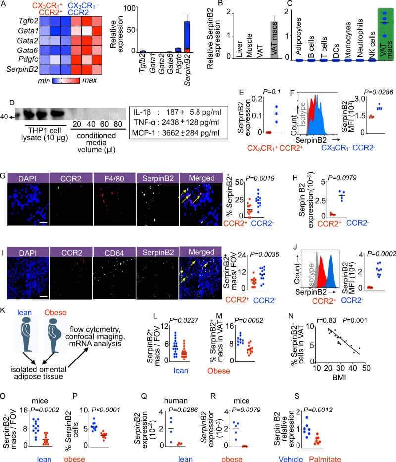 Fig.3 Resident macrophages in visceral fat highly express SerpinB2 and are linked to metabolic homeostasis. (Vasamsetti, et al., 2026)