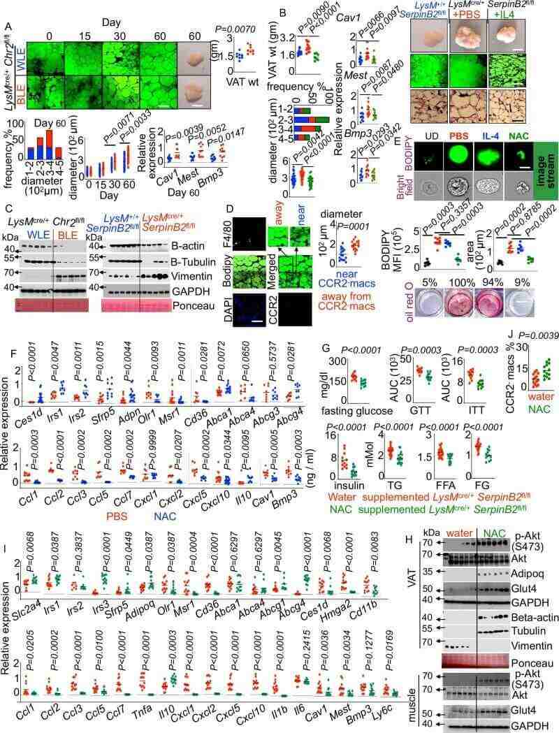 Fig.7 Glutathione signaling limits visceral fat growth and adipocyte enlargement in obesity. (Vasamsetti, et al., 2026)