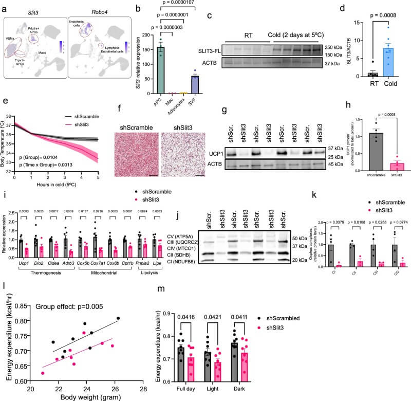 Fig.1 SLIT3 supports brown fat heat production and energy metabolism during cold exposure. (Serdan, et al., 2026)