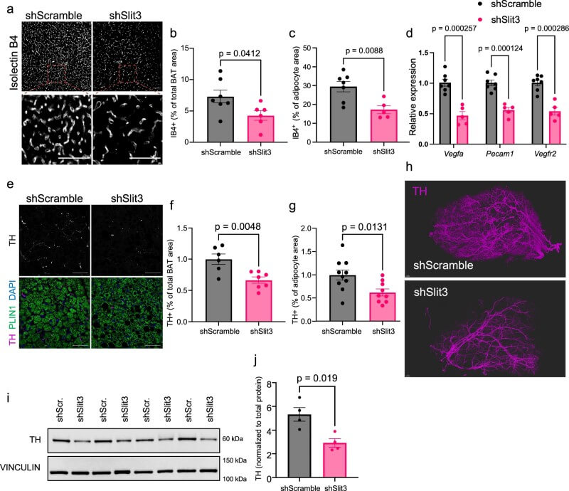 Fig.2 Reduced Slit3 expression weakens vascular growth and nerve signaling in brown adipose tissue. (Serdan, et al., 2026)