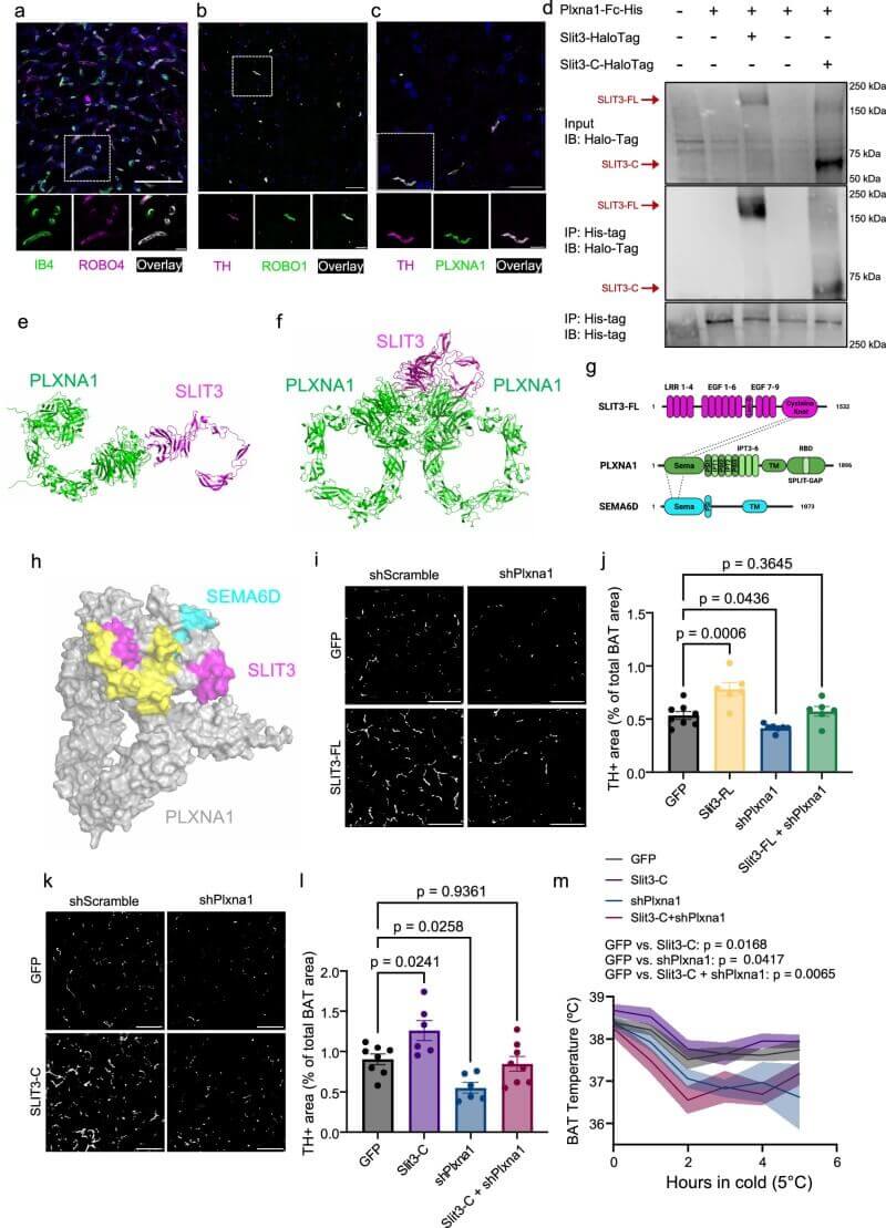 Fig.4 PLXNA1 interacts with SLIT3 to control sympathetic nerve activity in brown fat. (Serdan, et al., 2026)