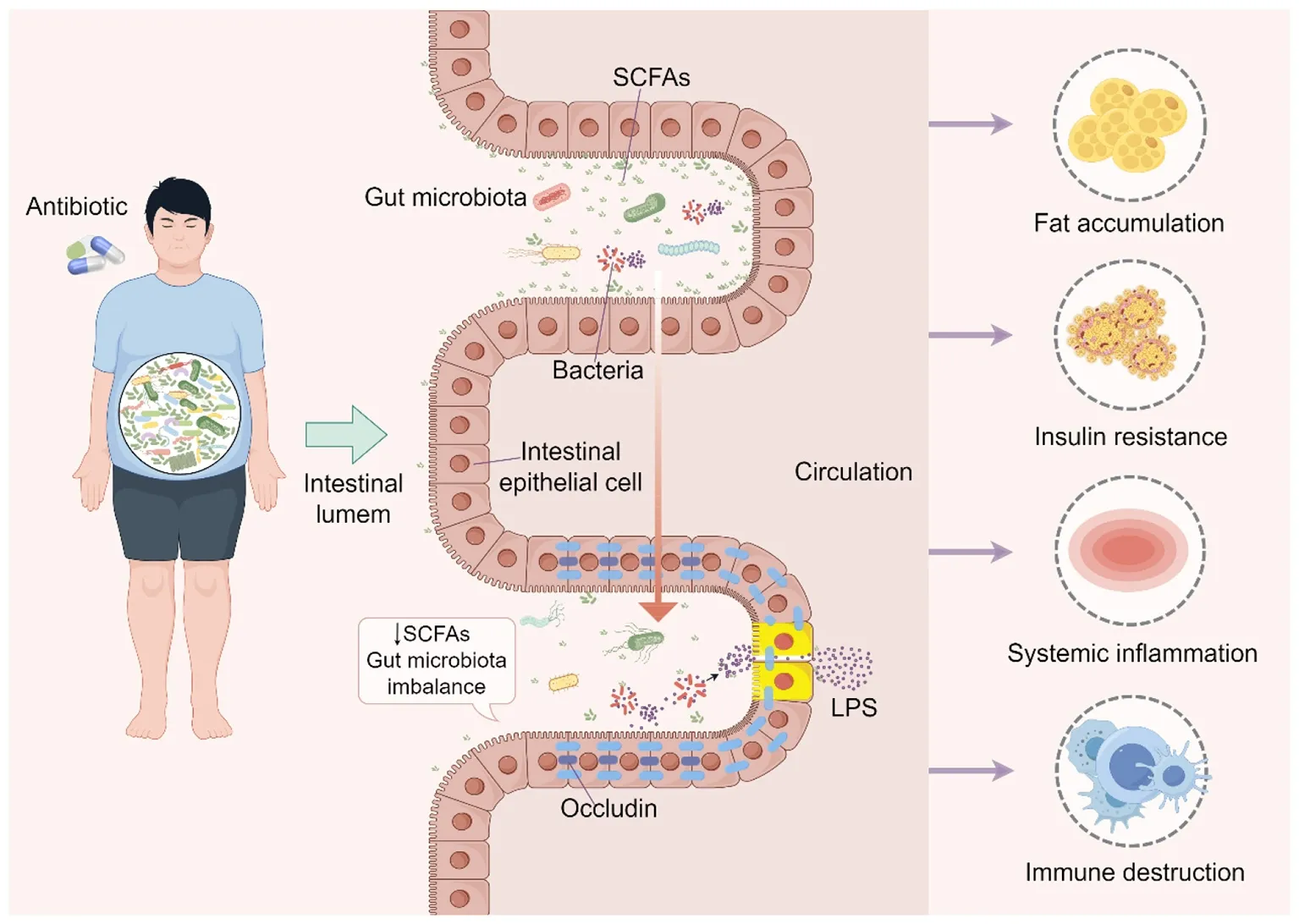 Reprogramming the Metabolome: How Antibiotic Exposure Drives Obesity and Metabolic Phenotypes via Gut Microbiota Dysbiosis